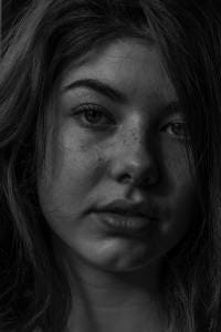 acne-prone skin