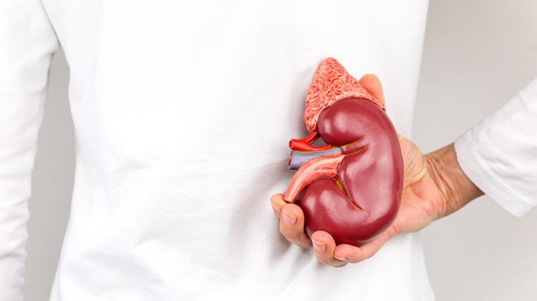 staghorn kidney stones