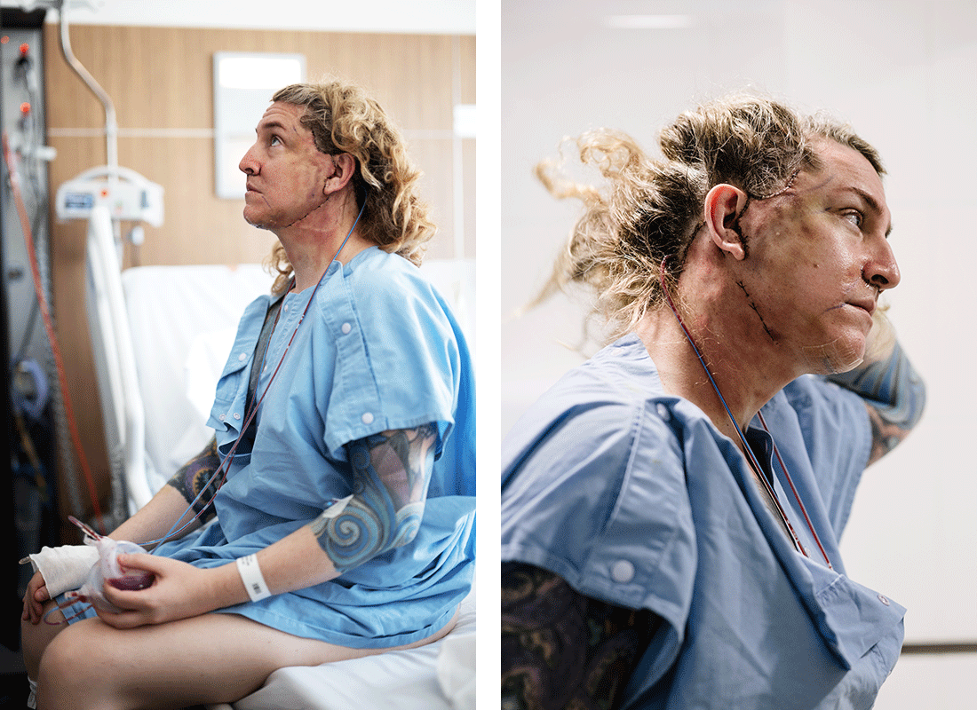 [Battered and bruised, barely able to walk]