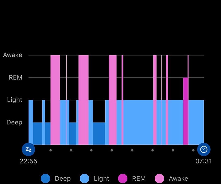 Two Garmin sleep tracking screenshots comparing poor and healthy sleep quality side by side