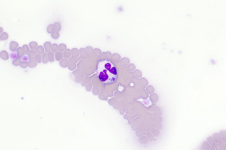 Anaplasma phagocytophilum morulae in neutrophils of dogs and cats on a peripheral blood smear northeast USA