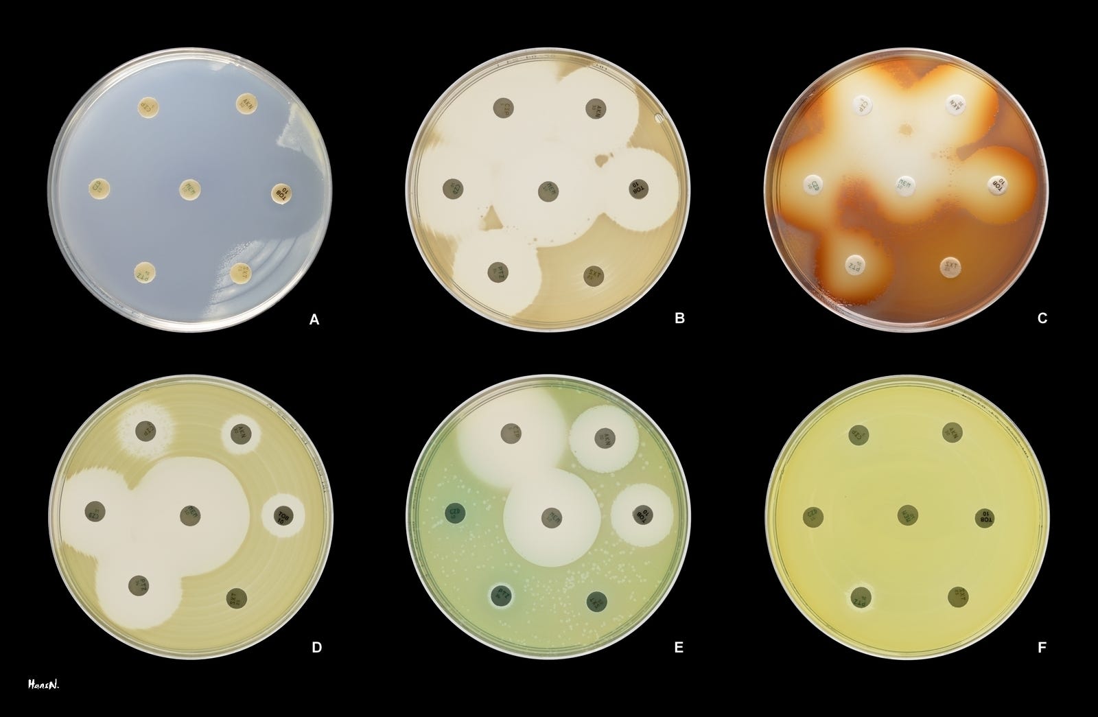 10 amazing antibiotic resistance tactics