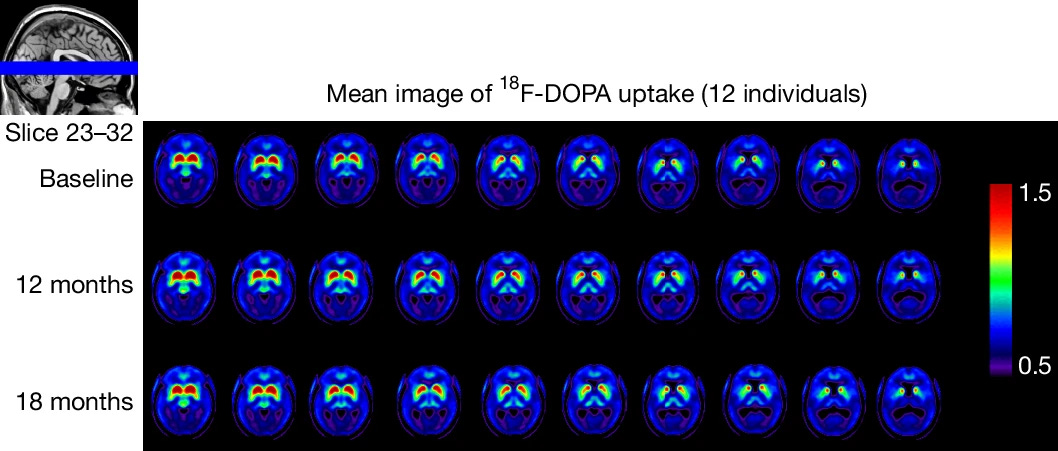 From the Tabar et al. (2025)