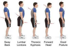 Standing Posture – How Am I Supposed To ...