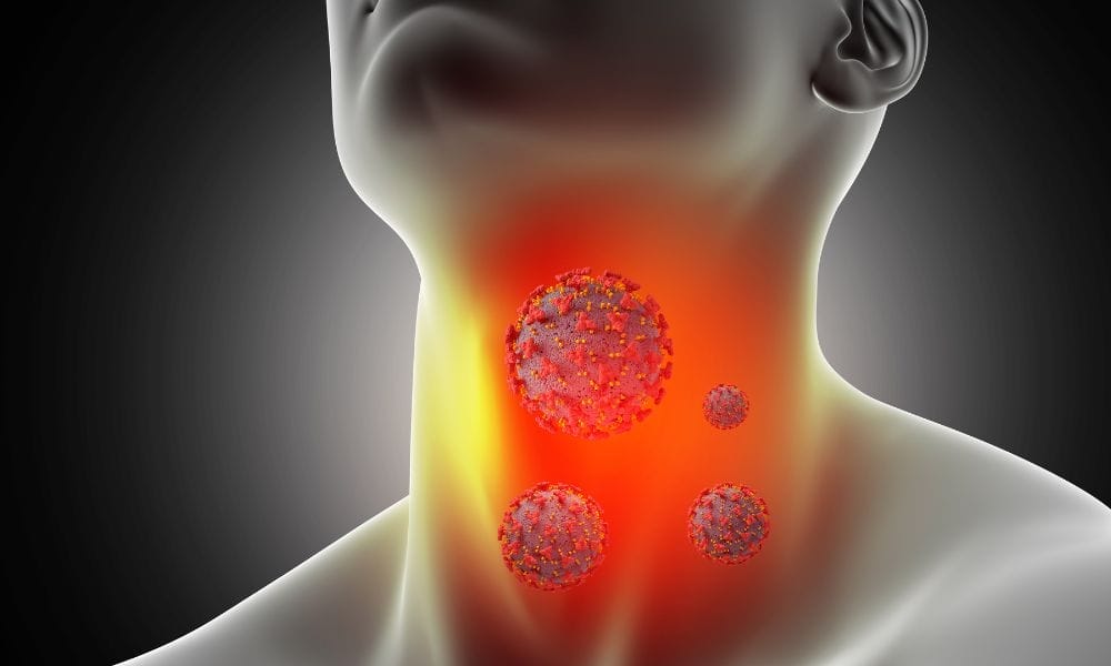 ▷ Linfoma De Hodgkin | Tratamiento | Panama Cancer Clinic ✓