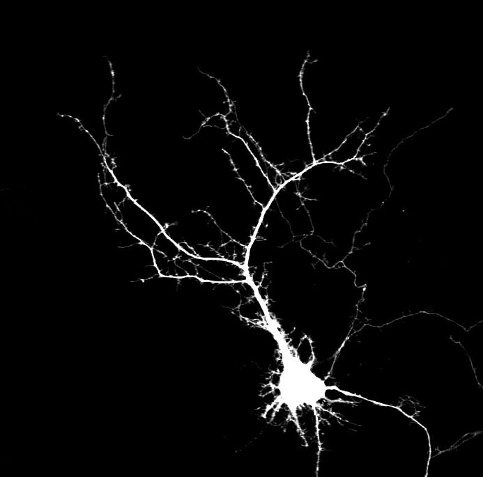 This may contain: the branches of a tree are glowing in the dark