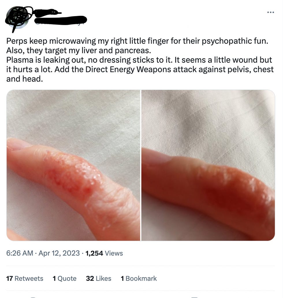 Perps keep microwaving my right little finger for their psychopathic fun. Also, they target my liver and pancreas. Plasma is leaking out, no dressing sticks to it. It seems a little wound but it hurts a lot. Add the Direct Energy Weapons attack against pelvis, chest and head. Perps keep microwaving my right little finger for their psychopathic fun. Also, they target my liver and pancreas. Plasma is leaking out, no dressing sticks to it. It seems a little wound but it hurts a lot. Add the Direct Energy Weapons attack against pelvis, chest and head.