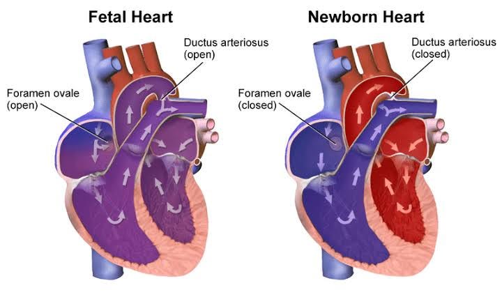 Foetal Vs Adult Circulation - TeachMeSurgery Foetal Vs Adult Circulation - TeachMeSurgery