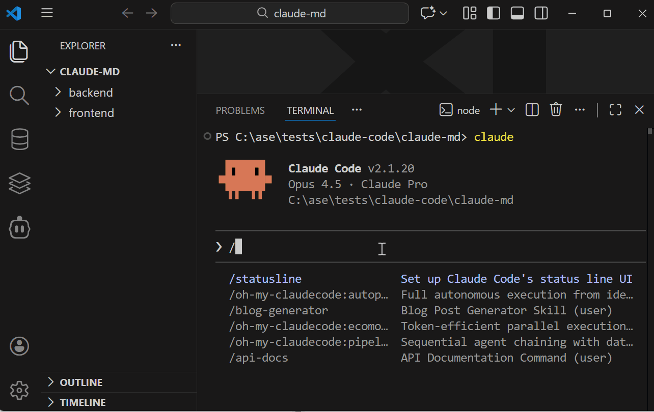 CLAUDE.md Masterclass: With Hooks, Subagents & Pro Automation