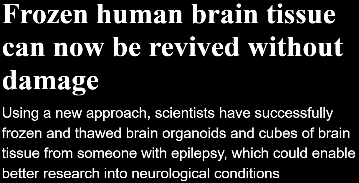 Why isn't there more discussion around Cryonics?
