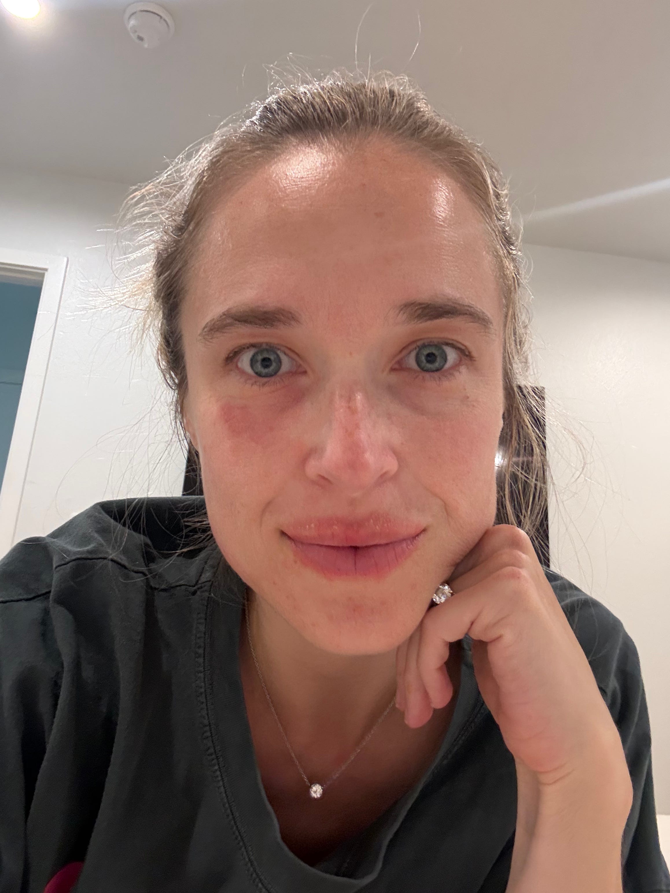 what my two week peptide break taught me, and why big pharma is so anti- peptides
