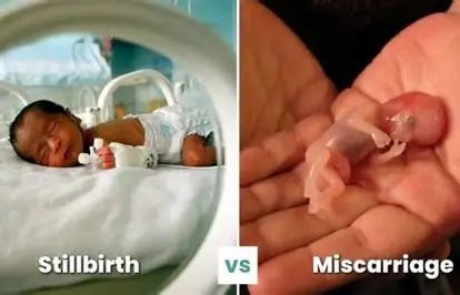 Image result for Stillbirth