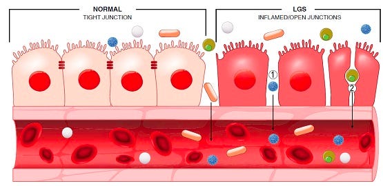 The Mystery and the Misery of Leaky Gut Syndrome | Mount Alvernia Hospital Singapore The Mystery and the Misery of Leaky Gut Syndrome | Mount Alvernia Hospital Singapore