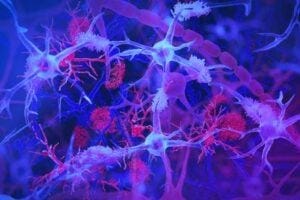 The brain's immune cells, or microglia (light blue/purple) are shown interacting with amyloid plaques (red) — harmful protein clumps linked to Alzheimer’s disease. The illustration highlights the microglia’s role in monitoring brain health and clearing debris. Illustration by Jason Drees/Arizona State University.