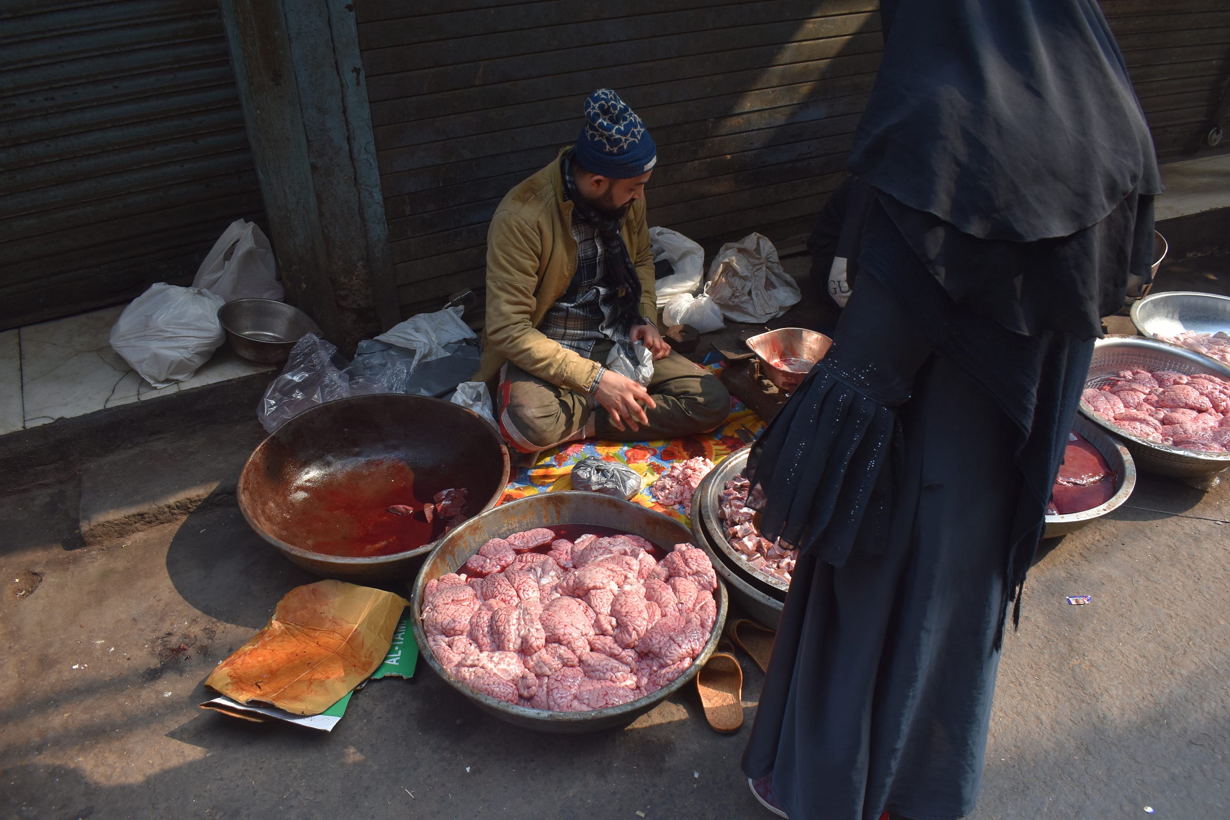 Oh, you think you're too good to eat brains from a bowl on the street?  Check your privilege.