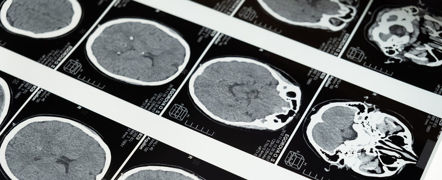 A series of brain scans, laid out in a grid.