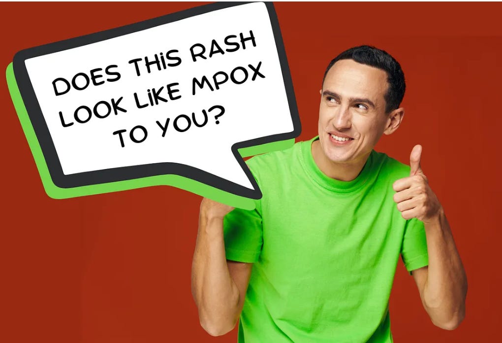 A socially awkward guy with a speech bubble that says "does this rash look like mpox to you?"