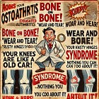 Patients Playbook | Understanding Osteoarthritis