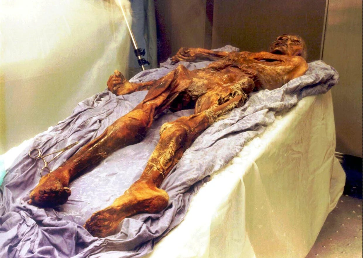 A table covered in a white sheet with a purple blanket on top, and on top of THAT there's a big ol nasty shriveled up mummy A table covered in a white sheet with a purple blanket on top, and on top of THAT there's a big ol nasty shriveled up mummy