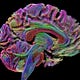psychedelirium