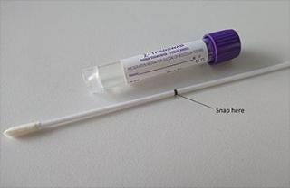 MCS (Genital Swabs) | North Bristol NHS Trust