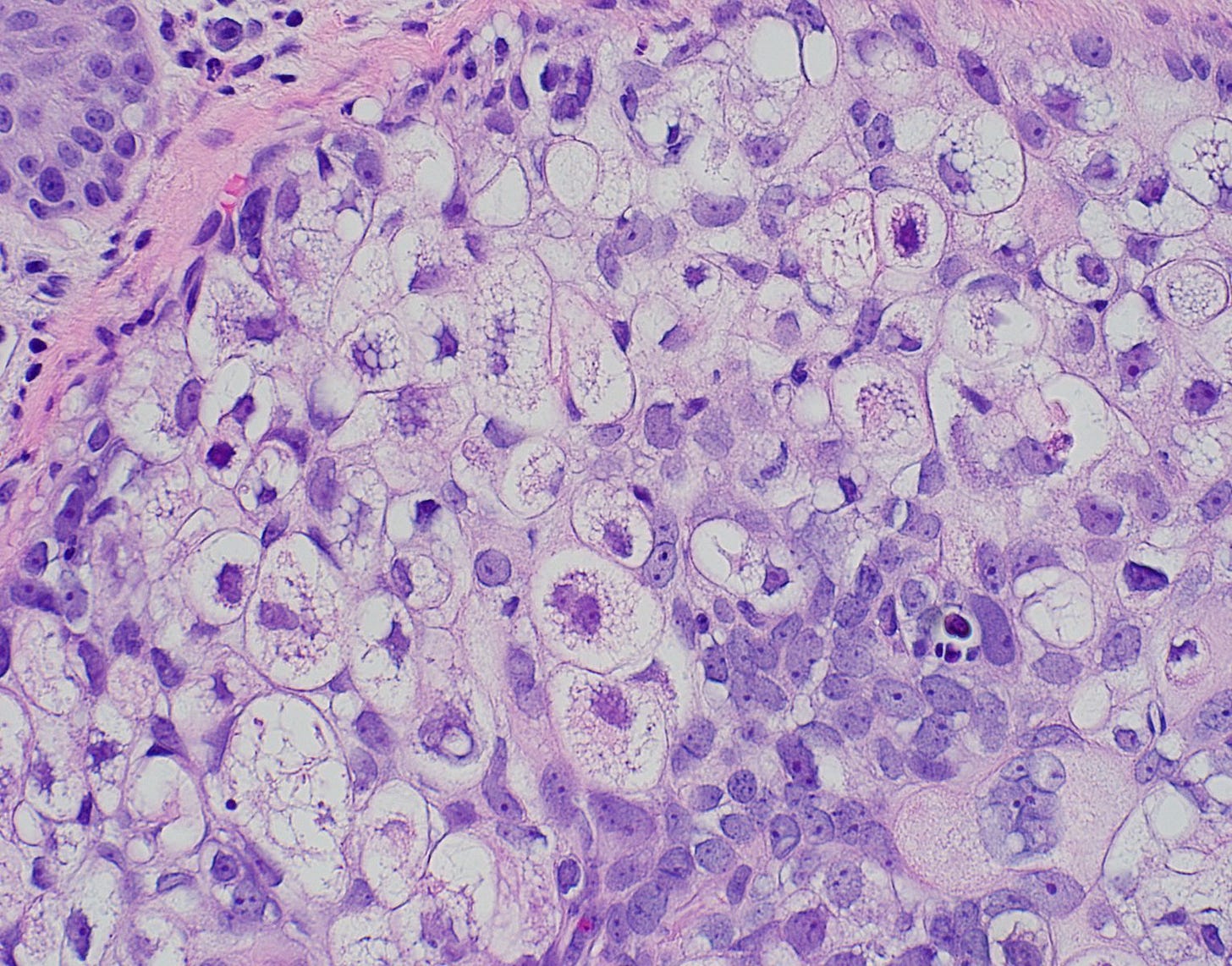 Multivacuolated cells Multivacuolated cells
