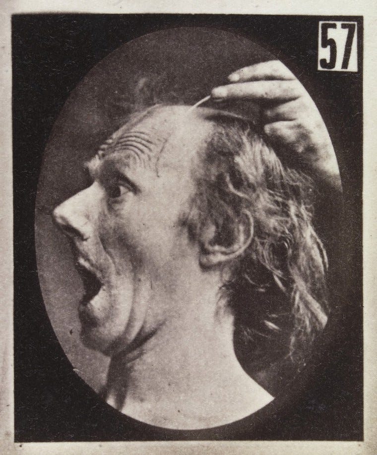 Experiments in physiology. Facial expressions; Amazement Guillaume Benjamin Amand Duchenne de Boulogne Experiments in physiology. Facial expressions; Amazement Guillaume Benjamin Amand Duchenne de Boulogne