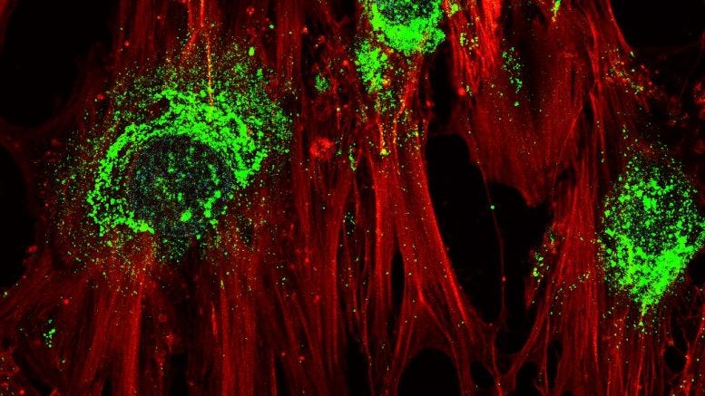 Stem Cells Turning Into Bone Cells Magnified