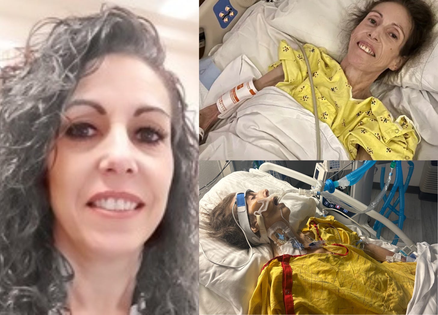 Nevada woman who fought for her life for two years in the hospital after the Covid-19 vaccine passes away, leaving behind $7.5 million in hospital bills that have bankrupted her family