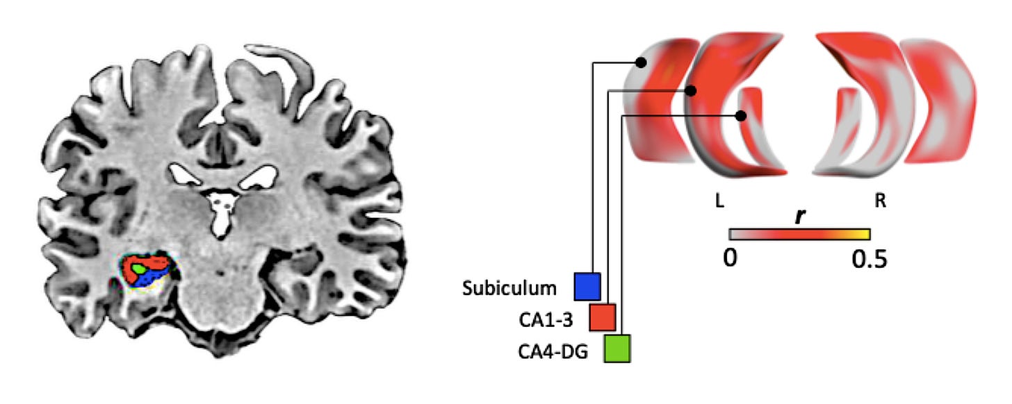Adapted from my own paper Tavakol et al., (2021) - coronal view of the brain with colour-coded hippocampal subfields (left) & corresponding coloured square labels with subfield surface templates (right). Adapted from my own paper Tavakol et al., (2021) - coronal view of the brain with colour-coded hippocampal subfields (left) & corresponding coloured square labels with subfield surface templates (right).