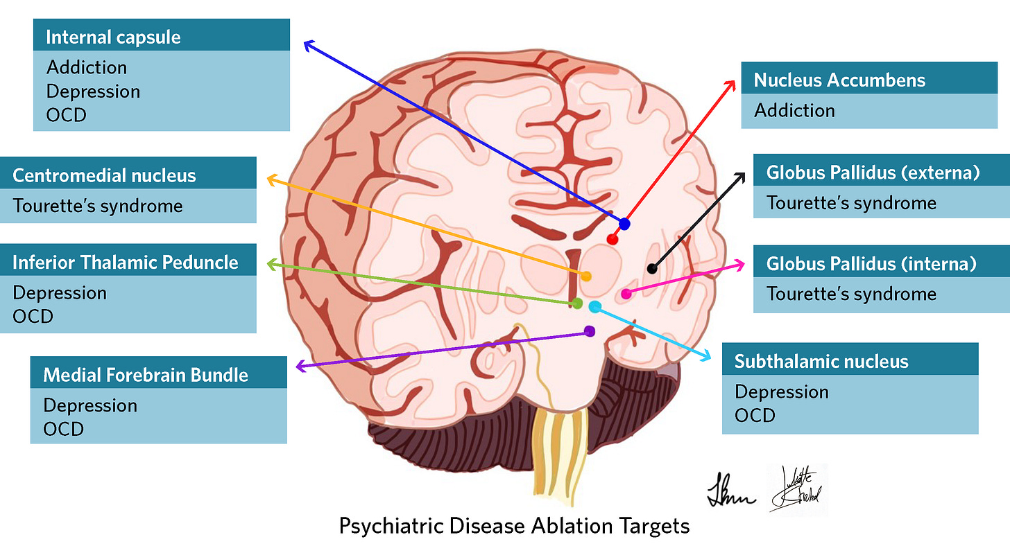 Brain labeled psychiatric targets