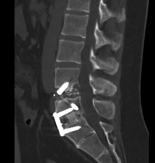 The X-Ray.