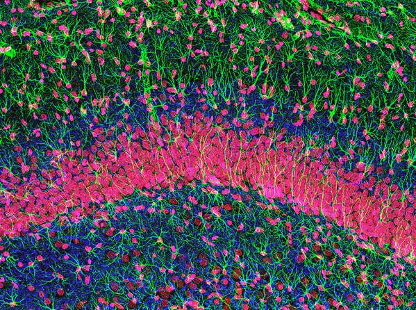 Hippocampus Poster featuring the photograph Hippocampus Brain Tissue by Thomas Deerinck, Ncmir Hippocampus Poster featuring the photograph Hippocampus Brain Tissue by Thomas Deerinck, Ncmir