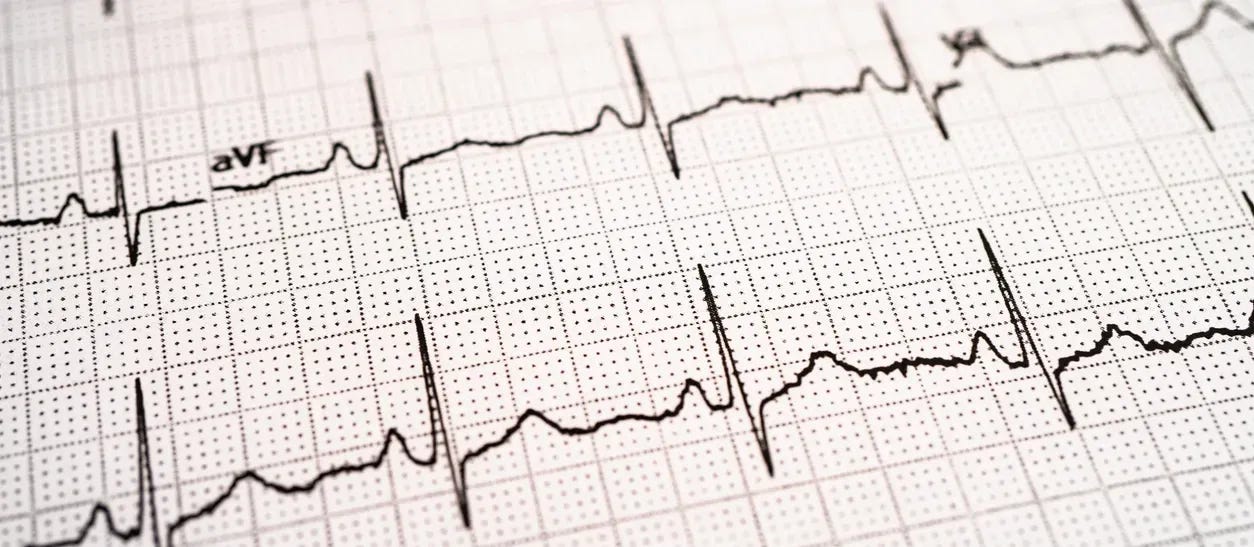 EKG (Electrocardiogram) in Tomball, TX | ECG Test Tomball