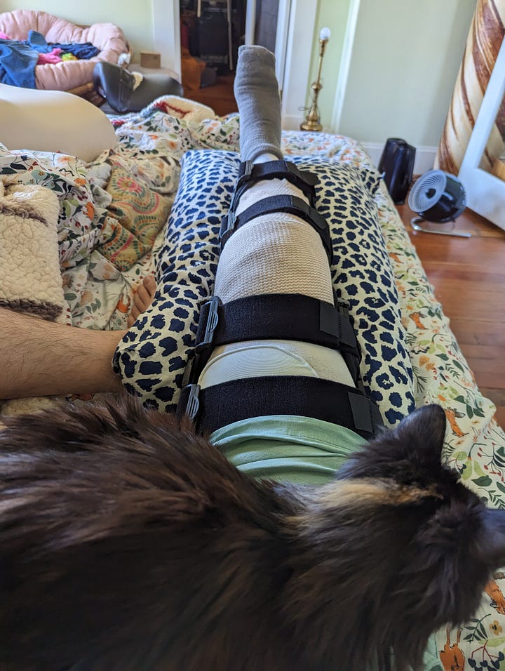 Eddie going through the first steps of recovering from tearing their ACL.
