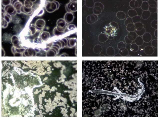 Figure 4: These 4 images illustrate the variety of unusual phenomena and objects found in the blood of subjects
vaccinated with Comirnaty (BioNTech/Pfizer). (German Working Group for COVID Vaccine Analysis (GWG))