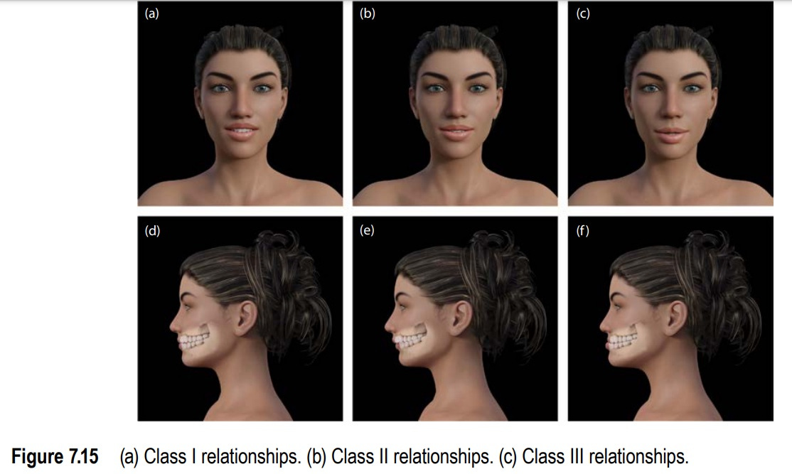 Perfiloplastia, harmonização facial