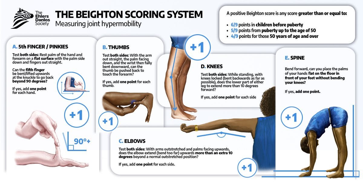 Assessing Joint Hypermobility - The Ehlers Danlos Society