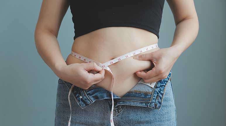 abdominal fat psoriasis risk