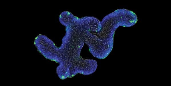 Intestinal Organoids