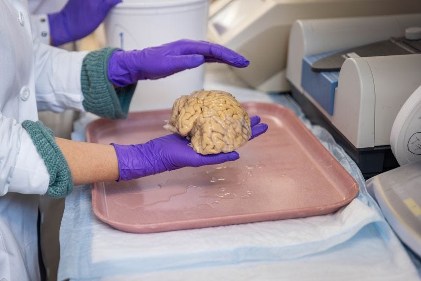 Researchers at Northwestern University have been studying the brains of SuperAgers for 25 years.