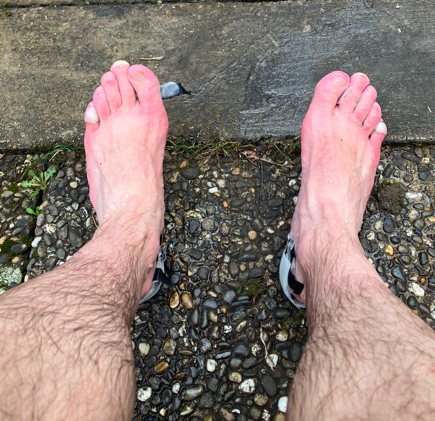 a picture of some feet with a few blister pads and bandages, recently cold plunged.
