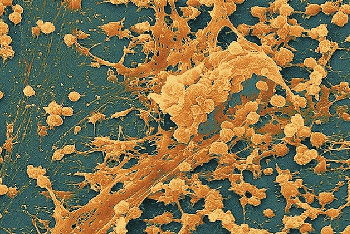 Identifying and eradicating biofilm | Health Facilities Management