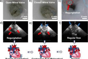 Endoscopic and ultrasound imaging of the mitral valve. (a) Opening and (b) closure of the mitral valve through endoscopic images. (c) Mitral valve with flow, observed after contraction. (d–f) Ultrasound images of the mitral valve (with a blue, downward arrow indicating regular flow and a red, upward arrow indicating regurgitation), (d) before, (e) during, and (f) after ventricular contraction, offered by the presence of McKibben actuators, with the respective cardiac cycle phases replicated in a corresponding schematic. Endoscopic and ultrasound imaging of the mitral valve. (a) Opening and (b) closure of the mitral valve through endoscopic images. (c) Mitral valve with flow, observed after contraction. (d–f) Ultrasound images of the mitral valve (with a blue, downward arrow indicating regular flow and a red, upward arrow indicating regurgitation), (d) before, (e) during, and (f) after ventricular contraction, offered by the presence of McKibben actuators, with the respective cardiac cycle phases replicated in a corresponding schematic.