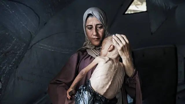 Muhammad Zakariya Ayyoub al-Matouq, con los huesos visiblemente marcados, en los brazos de su madre Muhammad Zakariya Ayyoub al-Matouq, con los huesos visiblemente marcados, en los brazos de su madre
