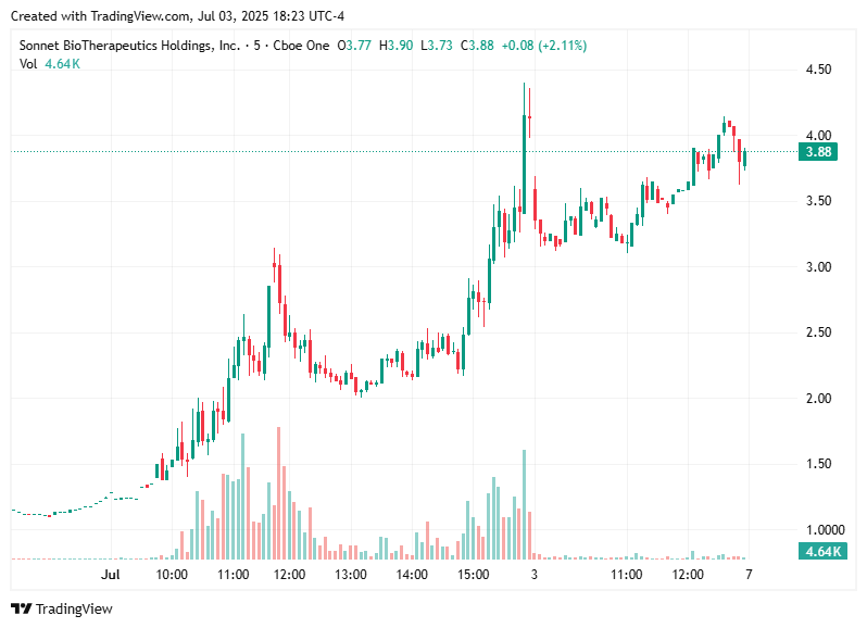 TradingView chart TradingView chart