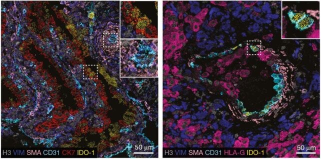 Two fluorescent microscopy images of placental cells at 6 and 16 weeks. Two fluorescent microscopy images of placental cells at 6 and 16 weeks.