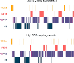 https://www.researchgate.net/publication/360812033/figure/fig1/AS%3A11431281112117232%401673323211348/Example-hypnograms-of-two-nights-with-either-low-REM-sleep-fragmentation-or-high-REM.png