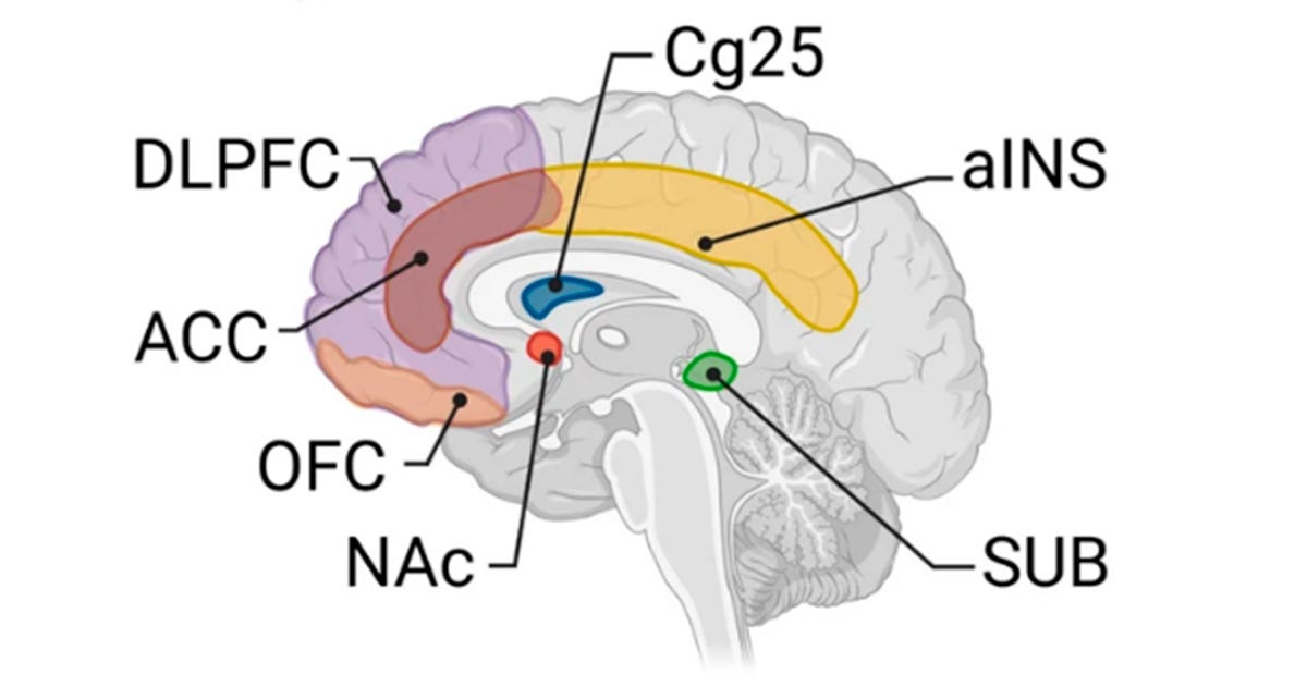 A imagem apresenta o cérebro visto de perfil (lado esquerdo), em tons de cinza para a anatomia geral. Sobre esse fundo, algumas regiões estão coloridas para facilitar a identificação: