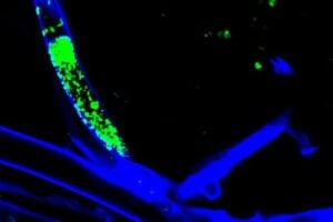The fluorescence image shows M. rhizoxinica bacteria (green) enclosed in parts of a fungal hyphal (blue).